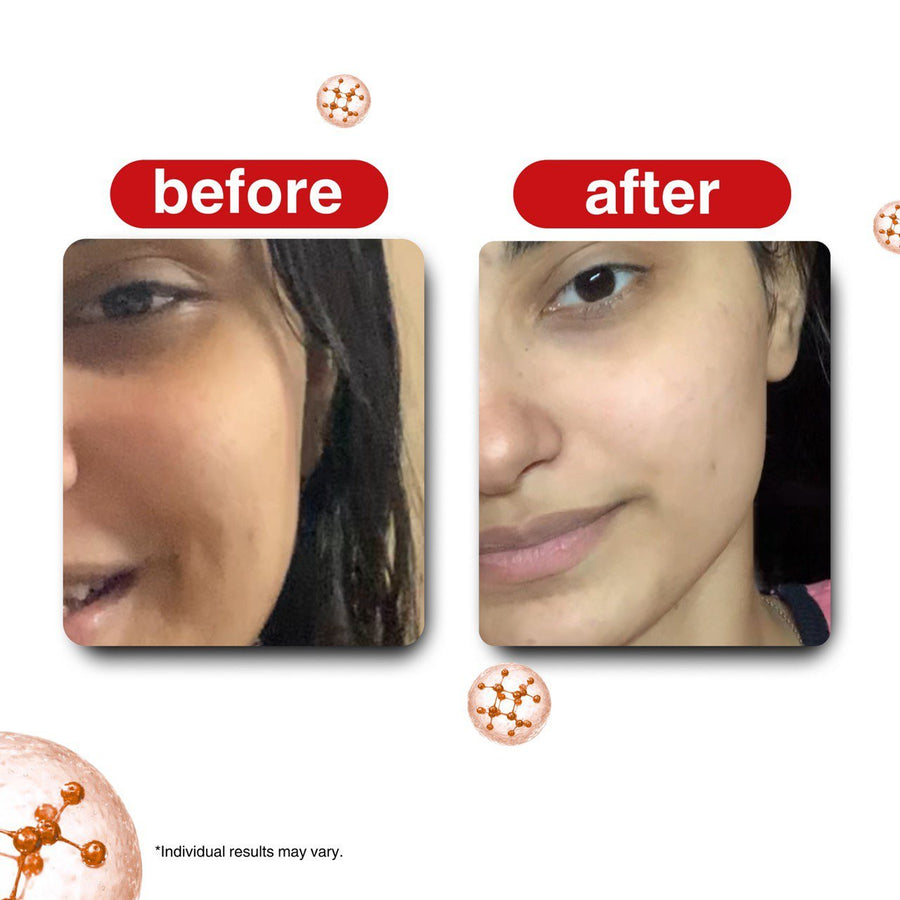 Deep Cleanse Centella Moroccan Red Clay Mask - Bonji