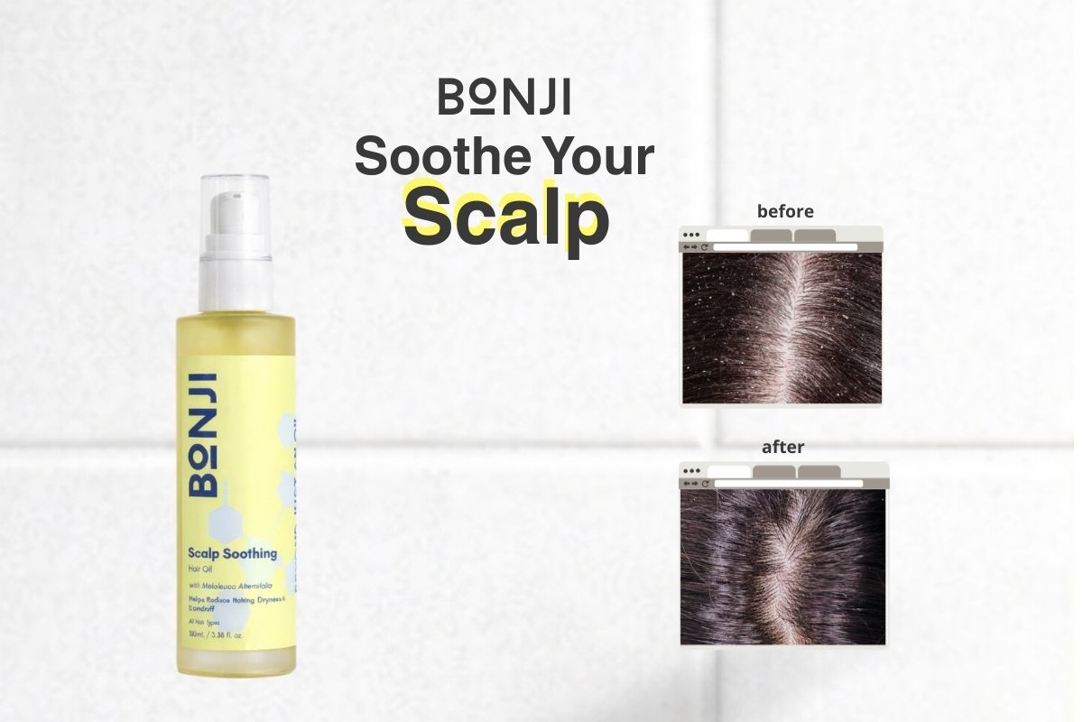 Bonji Scalp Soothing Hair Oil for dandruff - before and after results