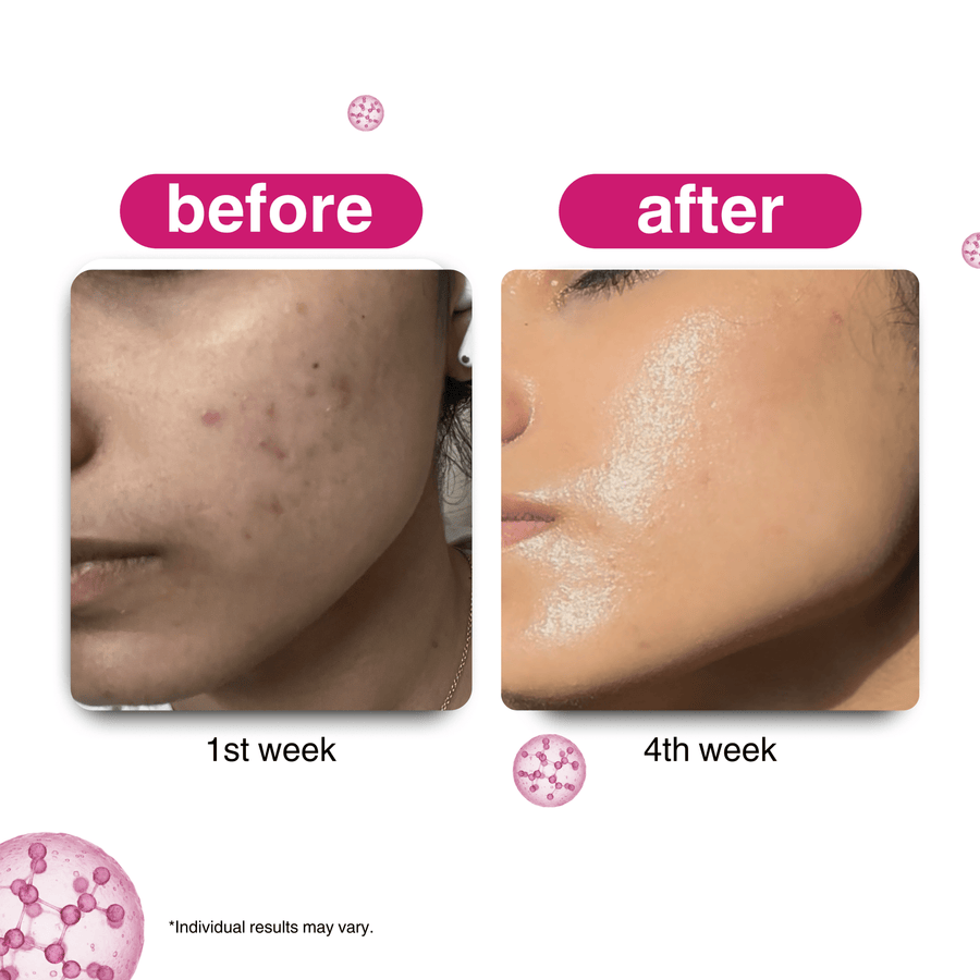 Milk Thistle + Vitamin B - 12 Face Serum - Bonji