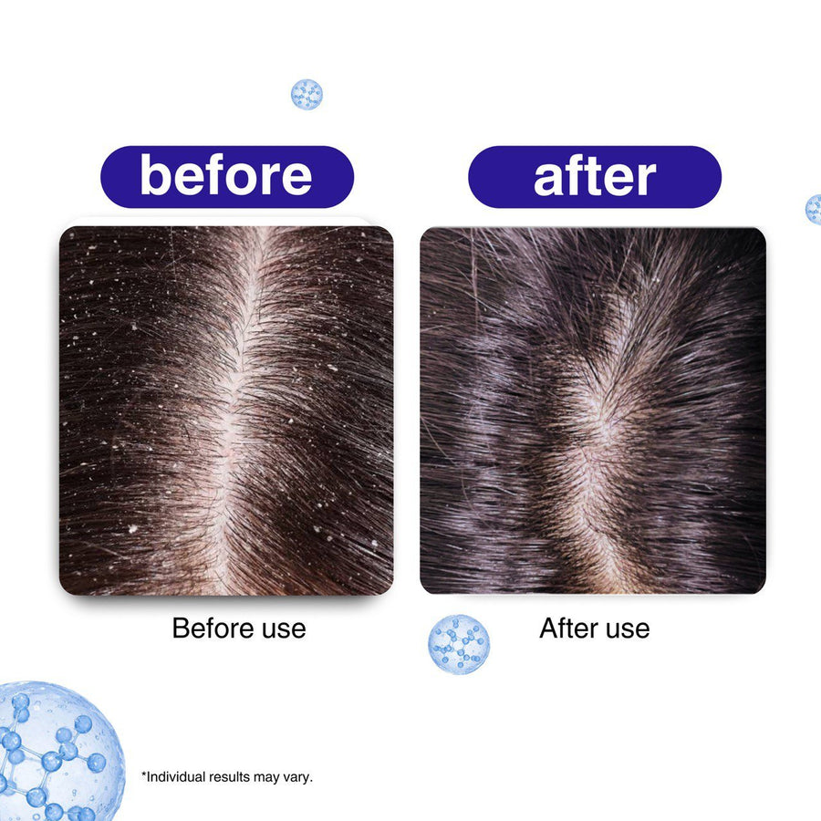 Scalp Soothing Hair Oil - Bonji